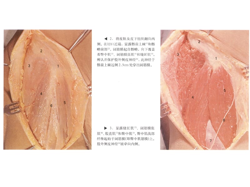 髋关节手术入呢路ppt课件.ppt_第3页