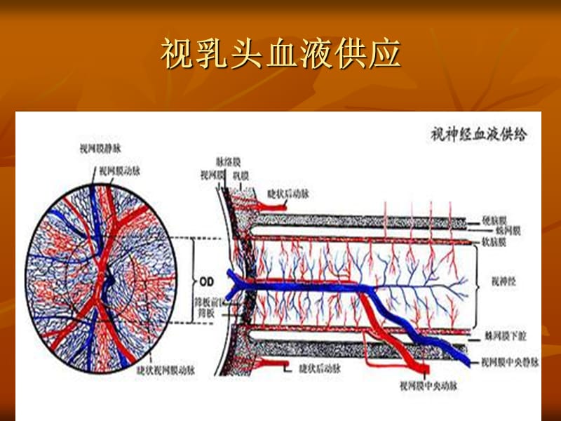 非动脉炎性义前部缺ppt课件.ppt_第3页