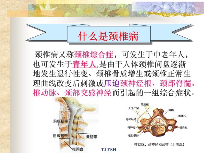 [颈椎病预防保健操].ppt_第2页