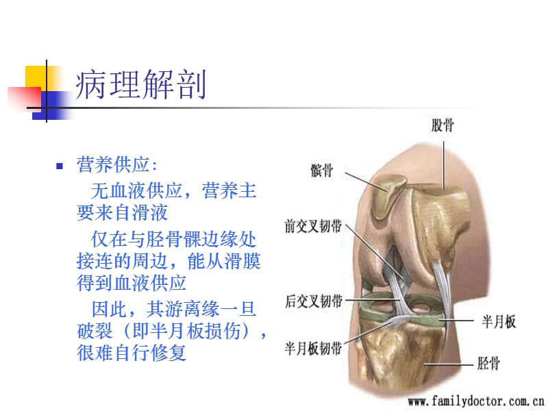 膝关节半月板损伤.ppt_第3页