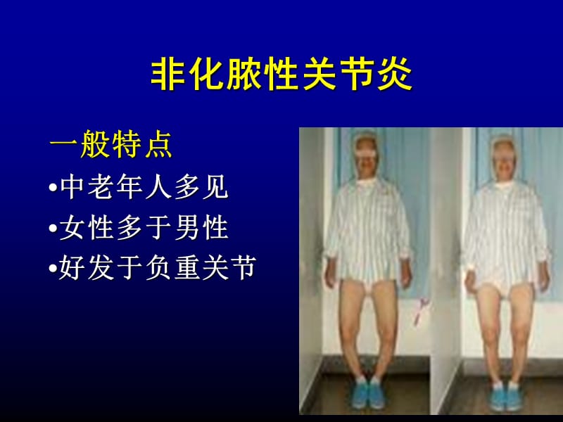 骨科-非化脓性关上节炎ppt课件.ppt_第3页