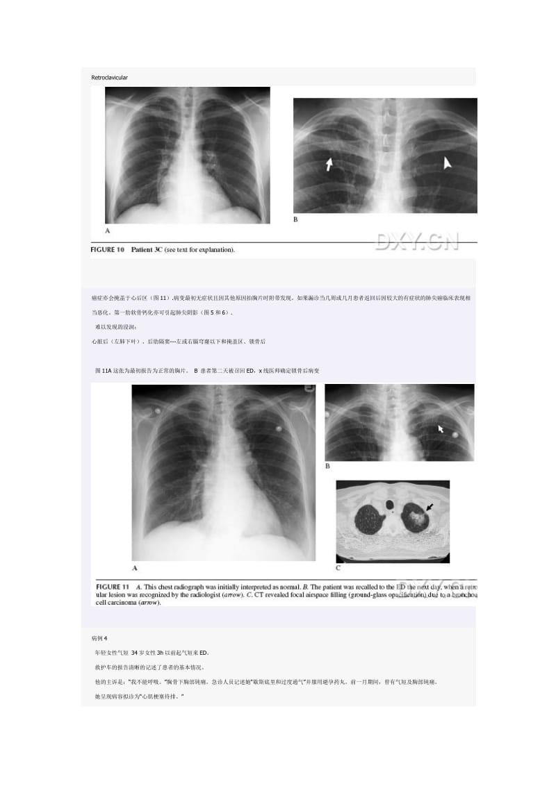 《急诊影像学》学习笔记.doc_第2页