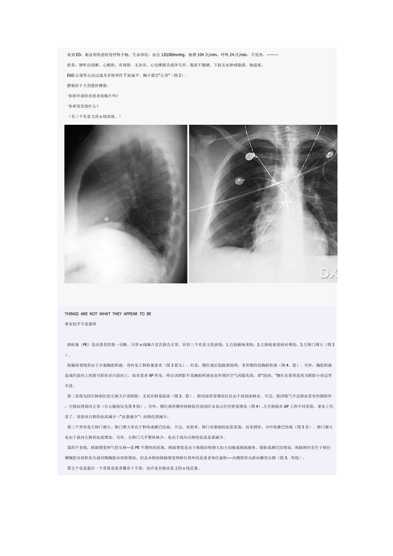 《急诊影像学》学习笔记.doc_第3页