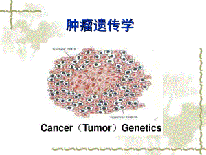 医学遗传学肿瘤遗传学ppt课件.ppt