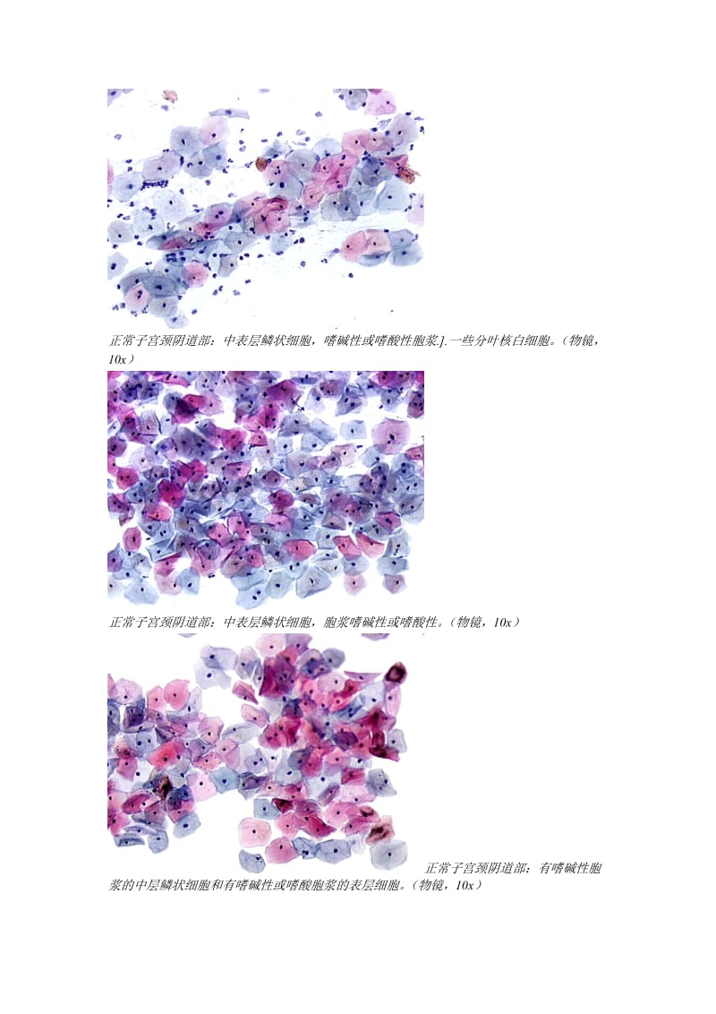 液基TCT图谱.doc_第2页