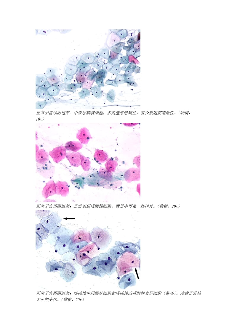 液基TCT图谱.doc_第3页