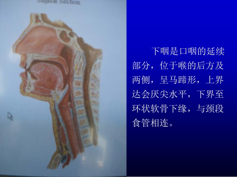 下咽癌介入影像治疗 (2).ppt_第3页