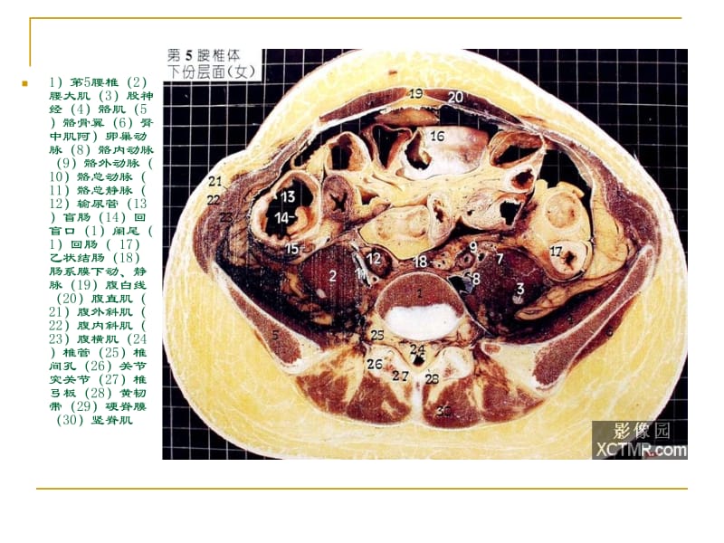 人体断层解剖图谱盆腔 (2).ppt_第3页