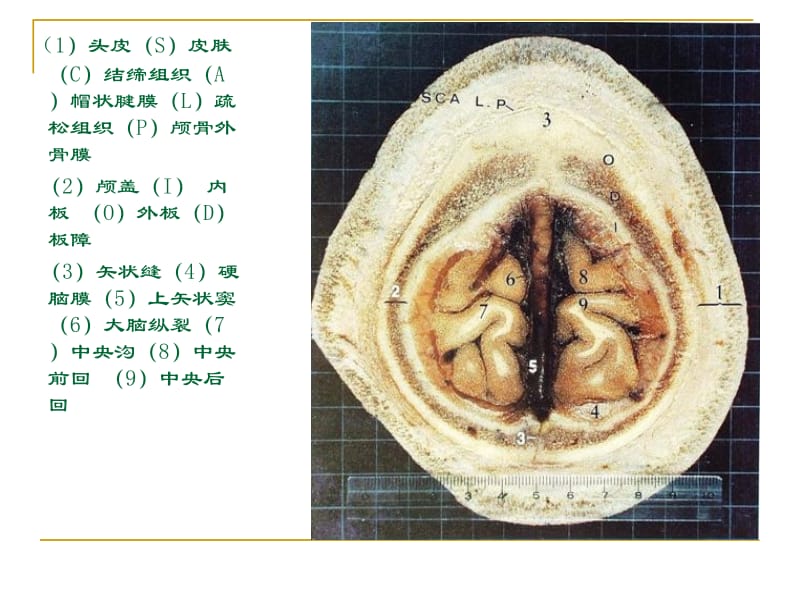 人体断层解剖图谱大脑 (2).ppt_第3页