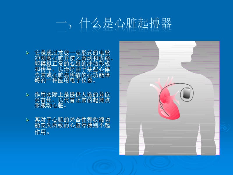 人工心脏起搏器.ppt_第3页