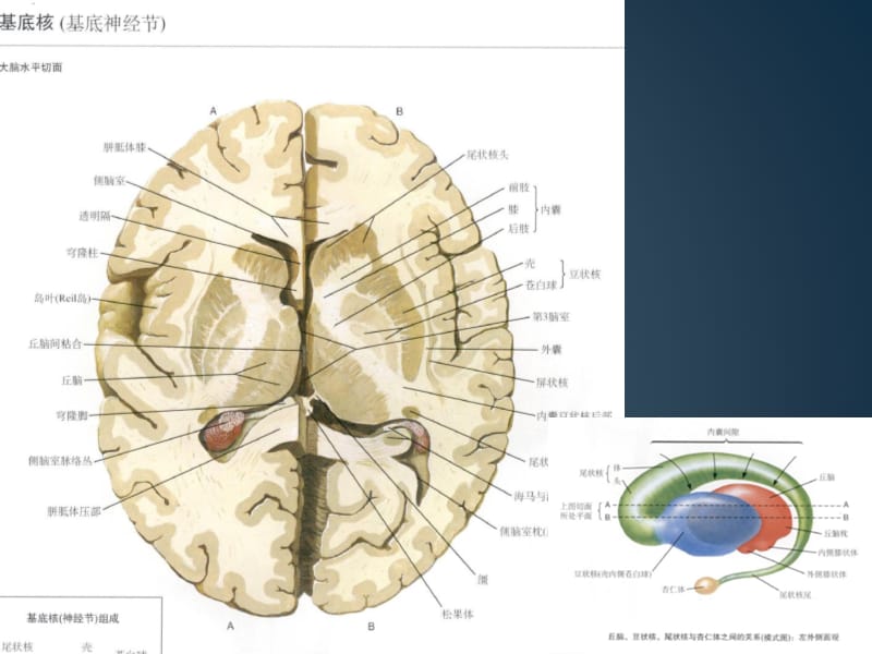 基底节区-丘脑区对称性病变总结归纳.ppt_第2页