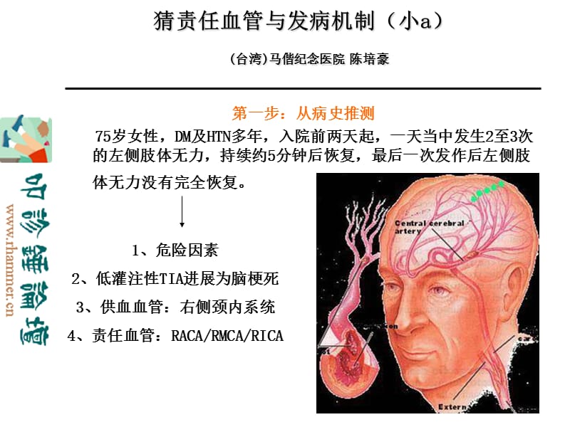 从影像学梗死部位推测责任供血血管.ppt_第2页