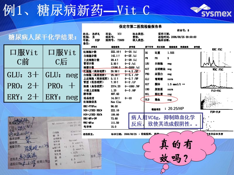 如何看目前的尿常规化验单 (2).ppt_第2页