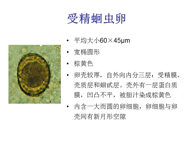 土线生活史、病原、诊断和操作知识.ppt_第2页