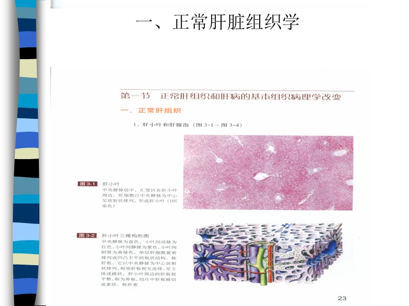 肝癌与肝炎关系.ppt_第3页