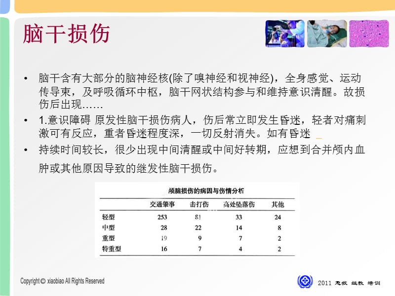 脑干损伤初探.ppt_第3页