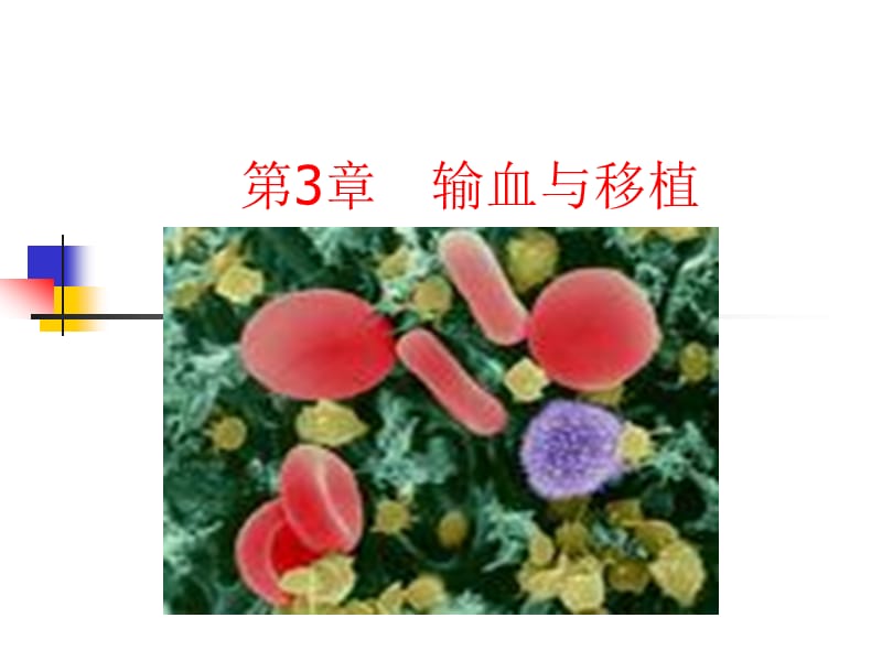 第3章输血与移植高职高专《外科学》第二版课件.ppt_第1页