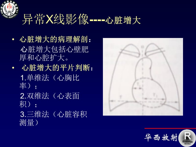 循环系统影像学2-2.ppt_第3页