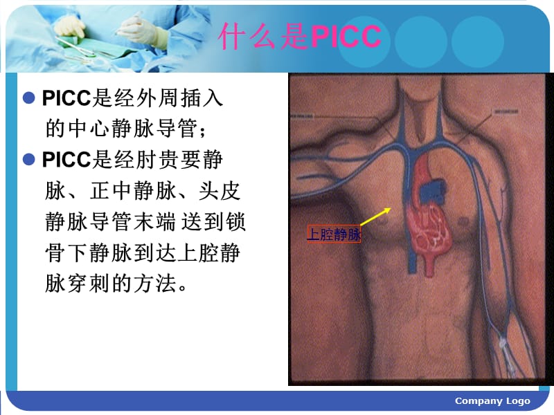 PICC置管与护理.ppt_第3页