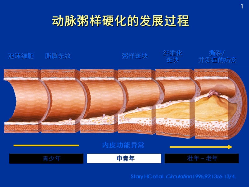 B阻滞剂与冠心病治疗1.ppt_第3页