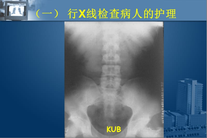 第十九章泌尿系统--泌尿系常用的诊疗操作.ppt_第3页