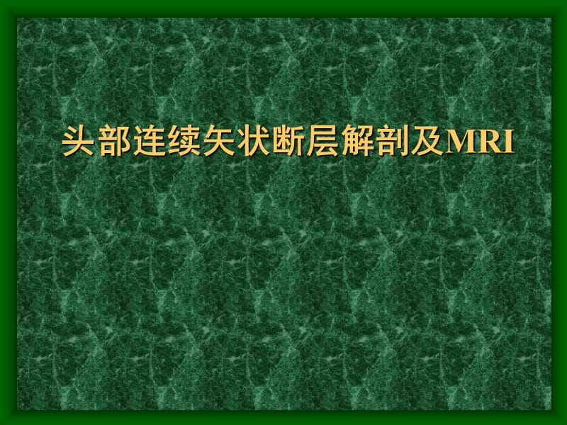 头部连续矢状断层解剖及MRI.ppt_第1页