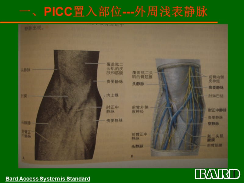 血管病理学.ppt_第3页