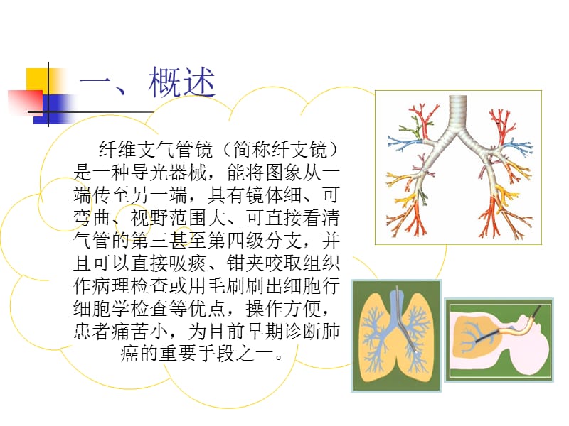 纤维支气管镜检查与护理33.ppt_第3页