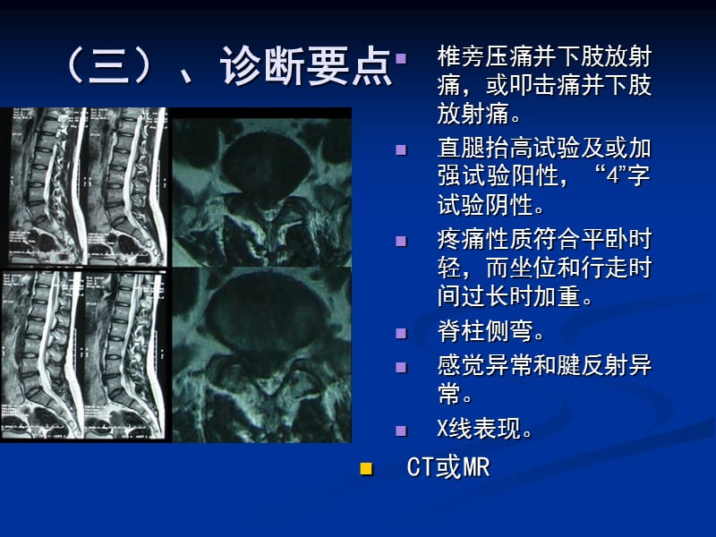 腰间盘突出症的康复治疗及相关问题.ppt_第3页