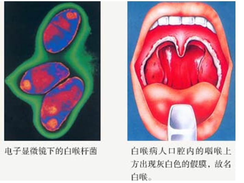 3白喉结核动物其他徐纪平编.ppt_第3页