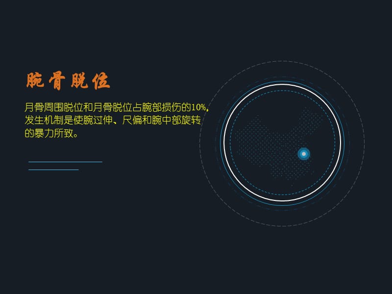 腕骨脱位ppt.ppt_第1页