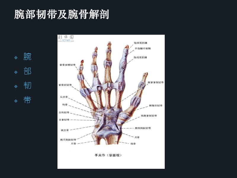 腕骨脱位ppt.ppt_第3页