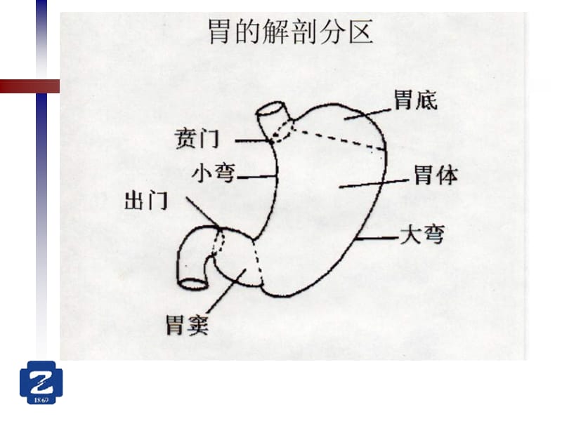 胃癌术后.ppt_第3页