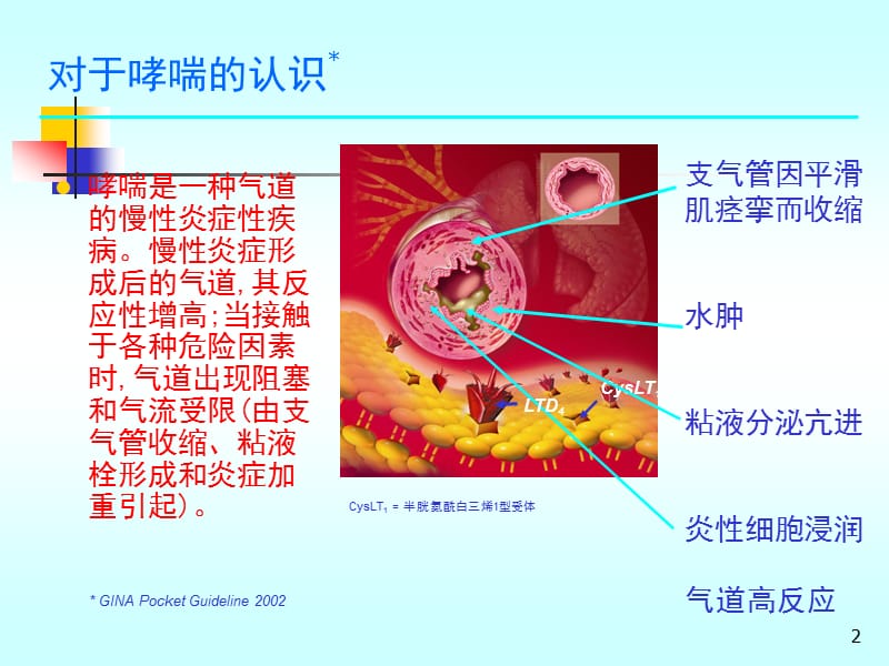 雾化吸入普米克在小儿哮喘等疾病的应用.ppt_第2页