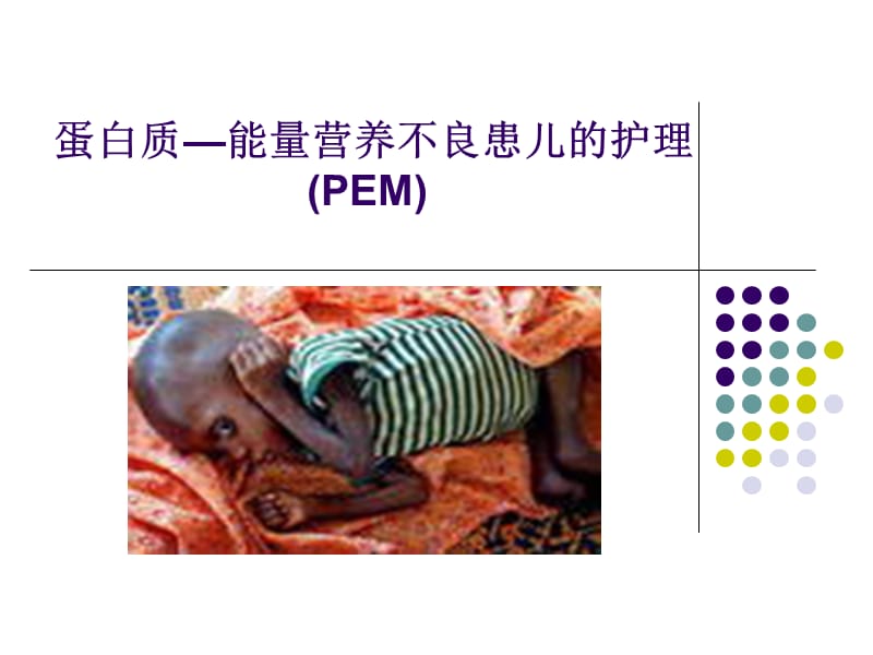 蛋白质—能量营养不良-1013 ppt课件.ppt_第1页