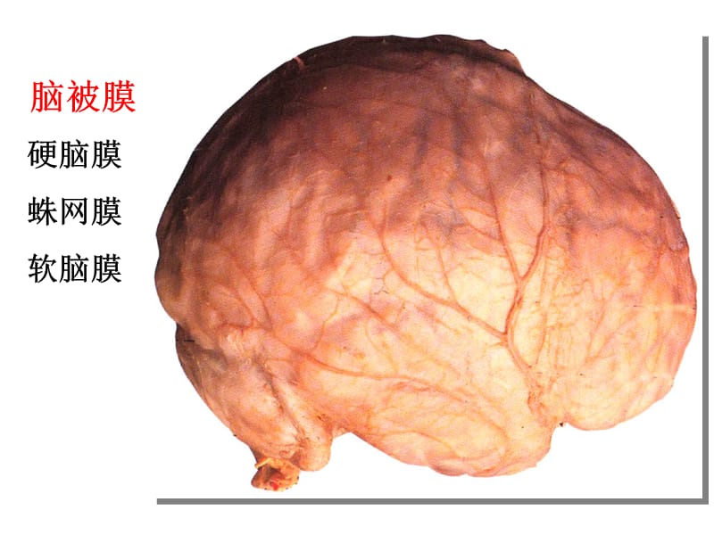 脑脊髓被膜血管脑室脑脊液.ppt_第3页