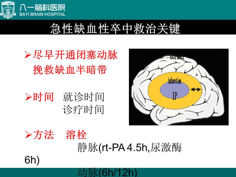 综合介入治疗急性缺血性脑卒中.ppt_第3页