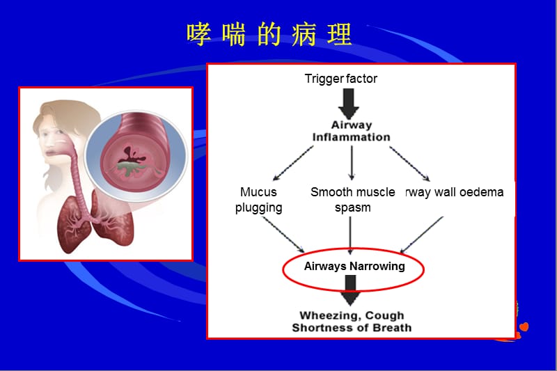 哮喘的炎症指标最新进展_节选.ppt_第2页