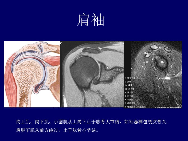 肩关节MRI.ppt_第3页