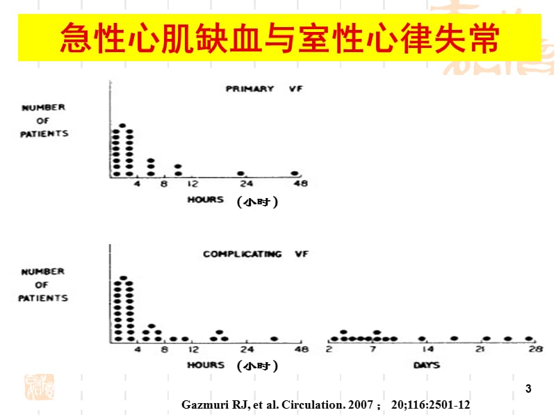 稳心颗粒缺血性室性心律失常.ppt_第3页