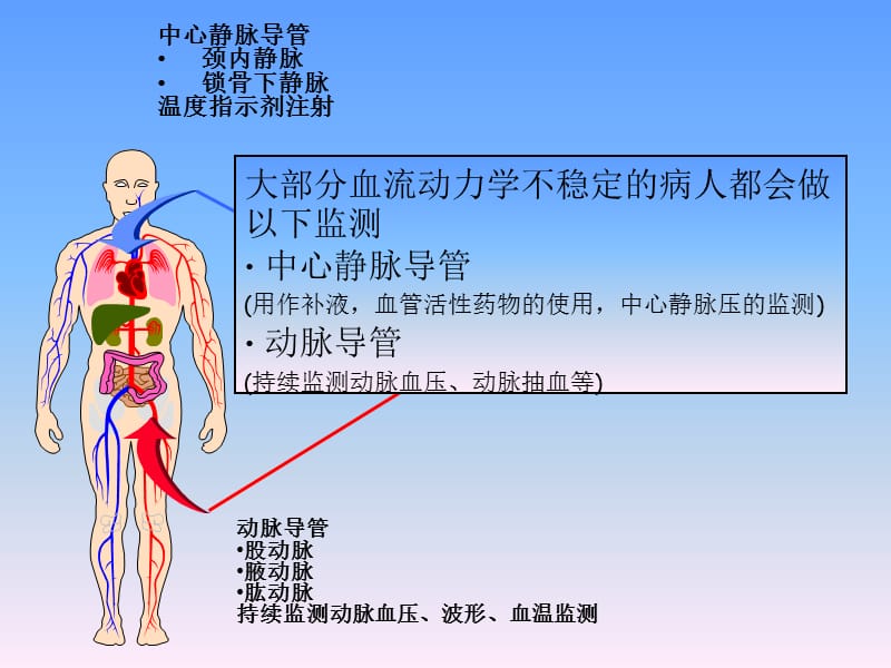 picco的监测与护理 ppt课件.ppt_第3页