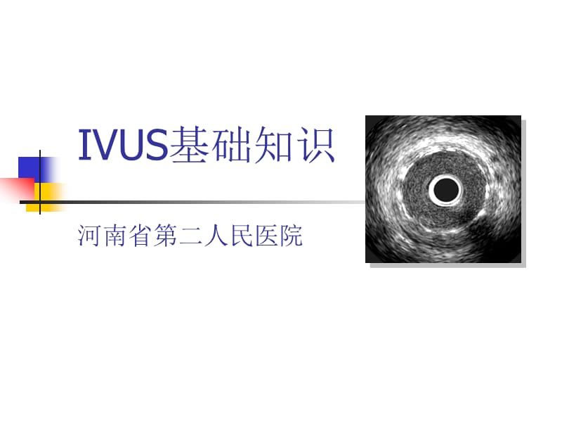 ivus基础知识 ppt课件.ppt_第1页