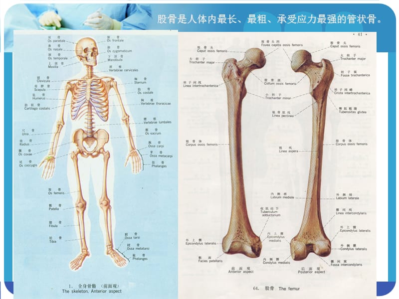 股骨骨折护理1.ppt_第3页