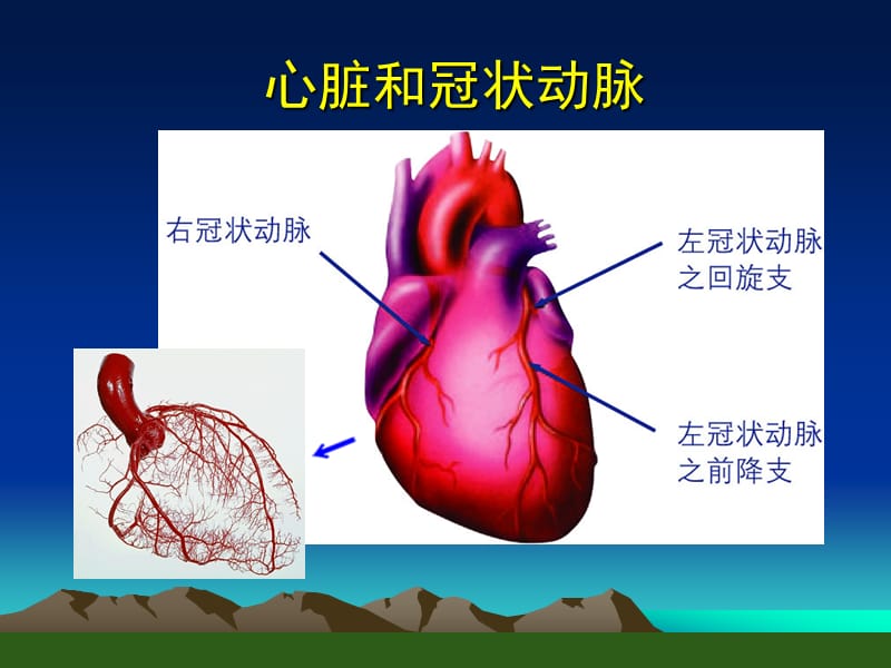 冠心病的临床表现、诊断与治疗.ppt_第2页