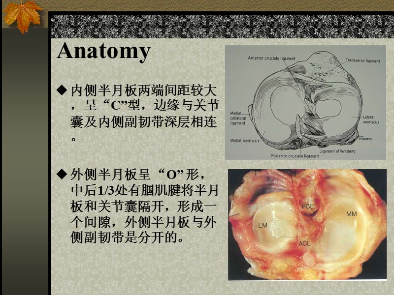 半月板损伤的诊断与治疗 ppt课件.ppt_第3页