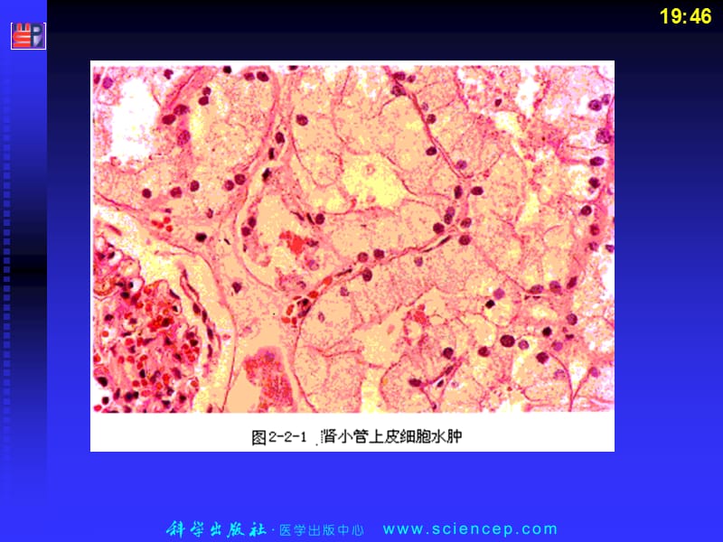 病理学基础病理组织图谱.ppt_第3页