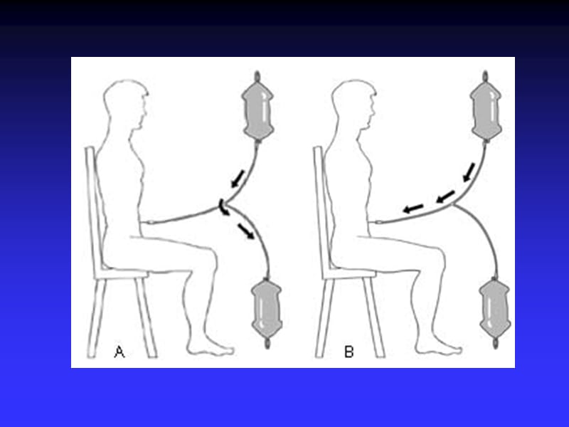 病房腹膜透析 ppt课件.ppt_第2页