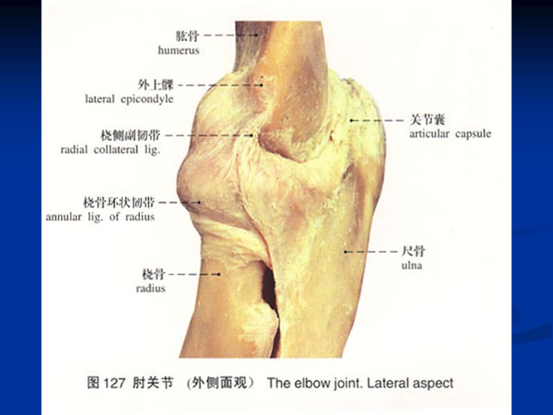 《中西医结合骨伤科学》17.尺骨鹰嘴骨折.ppt_第2页