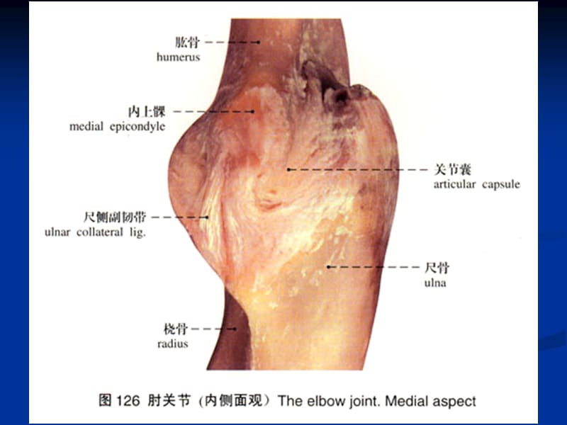 《中西医结合骨伤科学》17.尺骨鹰嘴骨折.ppt_第3页