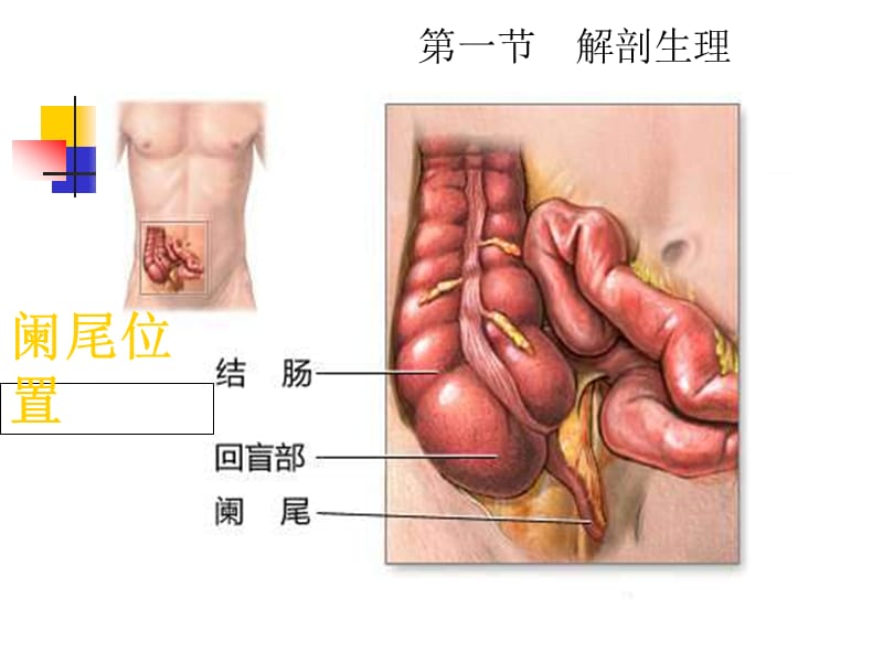 外科学教学课件（暨南大学）本科生大课-急性阑尾炎.ppt_第2页